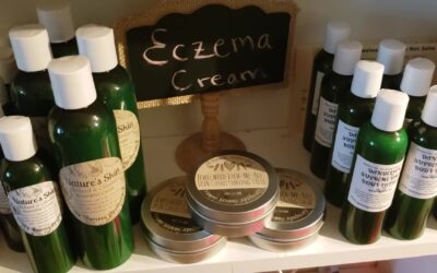 Eczema, Stop Suppressing It!