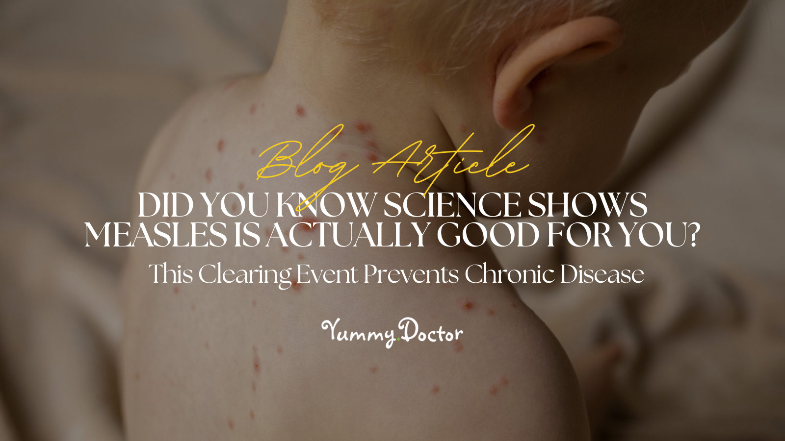 Yummy Doctor Holistic Health Education - Blog - Did You Know Science Show Measles Is Actually Good For You