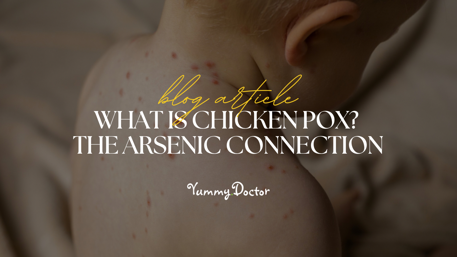 Yummy Doctor Holistic Health Education - Blog - What is Chicken Pox The Arsenic Connection